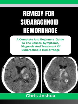 cover image of REMEDY FOR SUBARACHNOID HEMORRHAGE